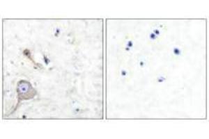 Immunohistochemical analysis of paraffin-embedded human brain tissue using S100 A1 antibody. (S1A1 Antikörper)