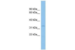 ACP5 antibody used at 1 ug/ml to detect target protein. (ACP5 Antikörper  (N-Term))