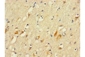 Immunohistochemistry of paraffin-embedded human brain tissue using ABIN7156163 at dilution of 1:100 (PLCL2 Antikörper  (AA 2-300))