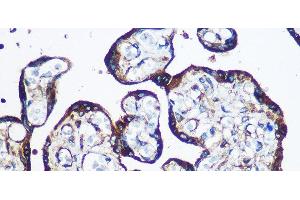 Immunohistochemistry of paraffin-embedded Human placenta using YTHDF2 Polyclonal Antibody at dilution of 1:100 (40x lens). (YTHDF2 Antikörper)
