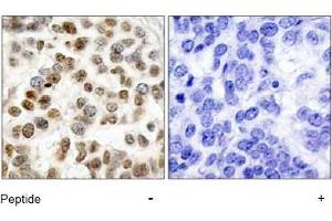 Image no. 1 for anti-Breast Cancer 1 (BRCA1) (Ser1423) antibody (ABIN197480) (BRCA1 Antikörper  (Ser1423))