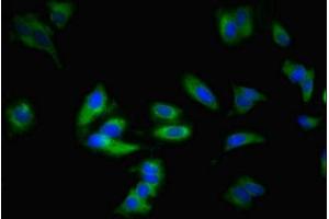 Immunofluorescent analysis of Hela cells using ABIN7143299 at dilution of 1:100 and Alexa Fluor 488-congugated AffiniPure Goat Anti-Rabbit IgG(H+L) (ADORA1 Antikörper  (AA 202-235))