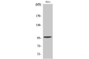 Western Blotting (WB) image for anti-Checkpoint Kinase 2 (CHEK2) (pThr68) antibody (ABIN5961583) (CHEK2 Antikörper  (pThr68))