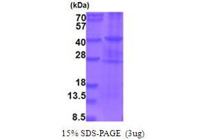 SDS-PAGE (SDS) image for Small Nuclear Ribonucleoprotein Polypeptide E (SNRPE) (AA 432-766) protein (His tag) (ABIN5854025)