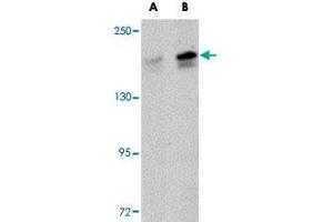 Western blot analysis of PALB2 in SK-N-SH cell lysate with PALB2 polyclonal antibody  at (A) 1 and (B) 2 ug/mL . (PALB2 Antikörper  (C-Term))