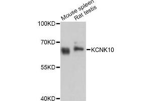 Western blot analysis of extracts of various cell lines, using KCNK10 Antibody (ABIN5998038) at 1:3000 dilution. (KCNK10 Antikörper)