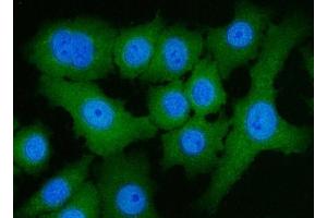 IF analysis of ACLY using anti-ACLY antibody (ABIN4886416). (ACLY Antikörper  (AA 1-180))