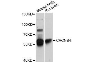 Western blot analysis of extracts of various cell lines, using CACNB4 antibody (ABIN5996096) at 1/1000 dilution. (CACNB4 Antikörper)