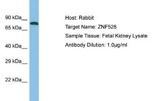 Host: Rabbit Target Name: ZNF526 Sample Type: Fetal Kidney lysates Antibody Dilution: 1. (ZNF526 Antikörper  (N-Term))