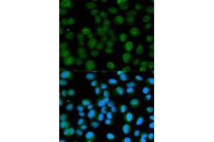 Immunofluorescence analysis of HeLa cells using EMD antibody. (Emerin Antikörper  (AA 1-220))