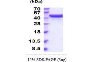 UGDH Protein (AA 1-493) (His tag)