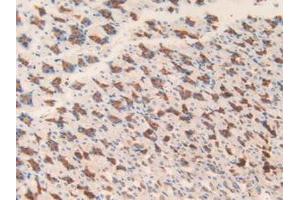 Detection of MGST1 in Mouse Stomach Tissue using Polyclonal Antibody to Microsomal Glutathione S Transferase 1 (MGST1)