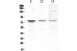 Western blot analysis of PLK2 using anti-PLK2 antibody .