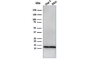 Western Blotting (WB) image for anti-beta-2-Microglobulin (B2M) antibody (ABIN6940416)