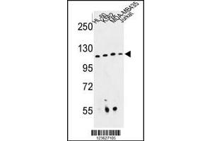 Western blot analysis of RPGRIP1 Antibody in HL-60, K562, MDA-MB435, Jurkat cell line lysates (35ug/lane) (RPGRIP1 Antikörper  (AA 530-557))