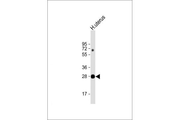 VGLL4 Antikörper  (AA 136-163)