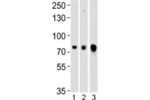 Western blot testing of Melk antibody at 1:1000 dilution and mouse 1) ovary, 2) spleen and 3) testis lysate (MELK Antikörper  (C-Term))