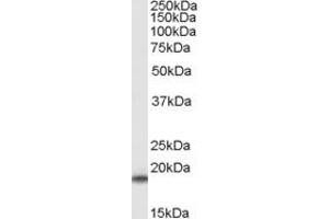 Western Blotting (WB) image for anti-Family with Sequence Similarity 170, Member B (FAM170B) (C-Term) antibody (ABIN2791529) (FAM170B Antikörper  (C-Term))