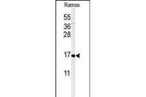 Western blot analysis of CMTM7 Antibody (N-term) (ABIN651213 and ABIN2840134) in Ramos cell line lysates (35 μg/lane). (CMTM7 Antikörper  (N-Term))