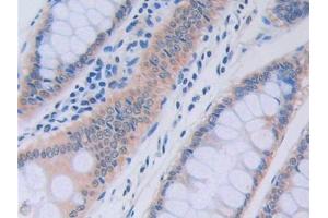 Used in DAB staining on fromalin fixed paraffin- embedded liver tissue (RNASE13 Antikörper  (AA 20-156))