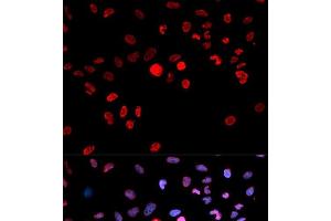Immunofluorescence analysis of MCF-7 cells using Phospho-CREB1(S133) Polyclonal Antibody (CREB1 Antikörper  (pSer133))