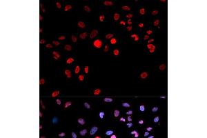 Immunofluorescence analysis of MCF-7 cells using Phospho-CREB1(S133) Polyclonal Antibody