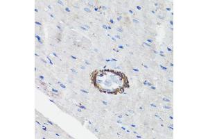 Immunohistochemistry of paraffin-embedded rat heart using Filamin A antibody (ABIN7267206) at dilution of 1:100 (40x lens). (Filamin A Antikörper  (C-Term))