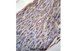BVES Antibody (C-term) immunohistochemistry analysis in formalin fixed and paraffin embedded human heart tissue followed by peroxidase conjugation of the secondary antibody and DAB staining.