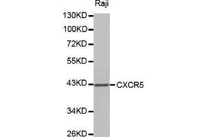 Western blot analysis of extracts of Raji cell lines, using CXCR5 antibody. (CXCR5 Antikörper)