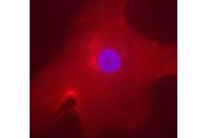 Immunofluorescent staining of MLXIPL in human hepatocyte using MLXIPL polyclonal antibody . (MLXIPL Antikörper  (AA 800-852))