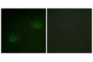 Immunofluorescence analysis of HeLa cells, using Syndecan4 (Ab-179) antibody. (SDC4 Antikörper  (Ser179))