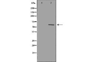Western Blotting (WB) image for anti-Cytochrome P450, Family 1, Subfamily B, Polypeptide 1 (CYP1B1) (Internal Region) antibody (ABIN6261168)