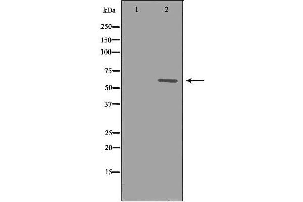 CYP1B1 antibody  (Internal Region)