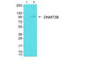 Western blot analysis of extracts from HuvEc cells (Lane 2), using DNMT3B antiobdy. (DNMT3B Antikörper  (N-Term))