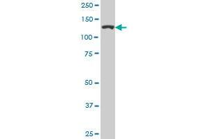 CAND1 monoclonal antibody (M05), clone 1G5. (CAND1 Antikörper  (AA 1-100))