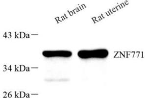 Western blot analysis of Znf771 (ABIN7076273)at dilution of 1: 500 (ZNF771 Antikörper)