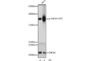 Western blot analysis of extracts of HeLa cells using Phospho-SMC1A(S957) Polyclonal Antibody at dilution of 1:1000. (SMC1A Antikörper  (pSer957))