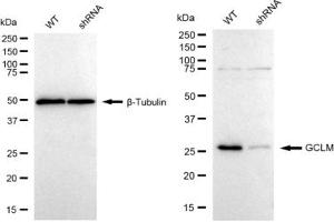 Western blotting analysis using GCLM antibody (ABIN7798743). (Rekombinanter GCLM Antikörper)