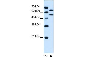 SIL1 antibody used at 0. (SIL1 Antikörper)