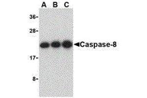 Western Blotting (WB) image for anti-Caspase 8 (CASP8) (C-Term) antibody (ABIN2477922) (Caspase 8 Antikörper  (C-Term))