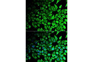 Immunofluorescence analysis of HeLa cell using DPP7 antibody. (DPP7 Antikörper)