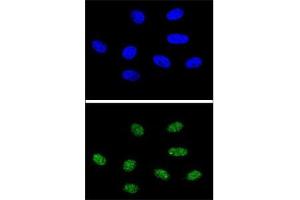 Confocal immunofluorescent analysis of PIN1 antibody with 293 cells followed by Alexa Fluor 488-conjugated goat anti-rabbit lgG (green).