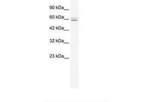Image no. 1 for anti-Core-binding Factor, Runt Domain, alpha Subunit 2, Translocated To, 3 (CBFA2T3) (N-Term) antibody (ABIN6735964)