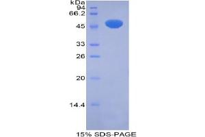 SDS-PAGE analysis of Rat Pregnane X Receptor Protein.