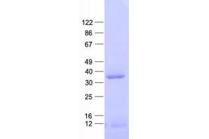 Western Blotting (WB) image for Caudal Type Homeobox 1 (CDX1) protein (His tag) (ABIN2713890)