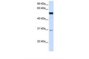 Image no. 1 for anti-Autoimmune Regulator (AIRE) (AA 218-267) antibody (ABIN6737664) (AIRE Antikörper  (AA 218-267))