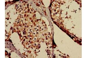 Immunohistochemistry of paraffin-embedded human testis tissue using ABIN7171472 at dilution of 1:100 (TAF6L Antikörper  (AA 345-433))