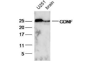 Lane 1:U251 lysates and Lane 2: Mouse brain lysates probed with Rabbit Anti-GDNF Polyclonal Antibody, Unconjugated  at 1:5000 for 90 min at 37˚C. (GDNF Antikörper  (AA 121-211))