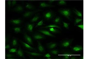 Immunofluorescence of monoclonal antibody to ZBTB7A on HeLa cell.