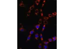 Immunofluorescence analysis of NIH/3T3 cells using  Rabbit pAb (ABIN6133587, ABIN6137053, ABIN6137054 and ABIN6224632) at dilution of 1:100. (Aquaporin 8 Antikörper  (AA 50-150))